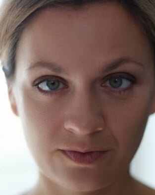 Adult Squint