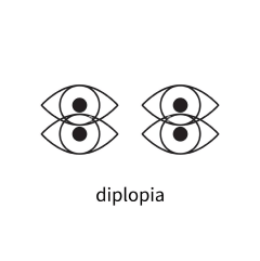 Diplopia Charting