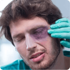 Injury