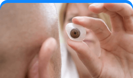 Socket and prosthetic eye