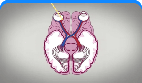Visual Pathway Disorders