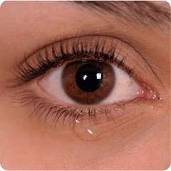 Watery eyes
