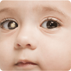 White Glow In Eyes